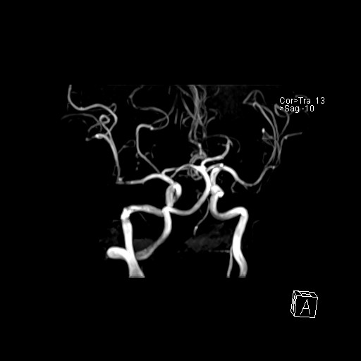 Click on the Serie image to view the images of VILLANUEVA, WILLIAM A.